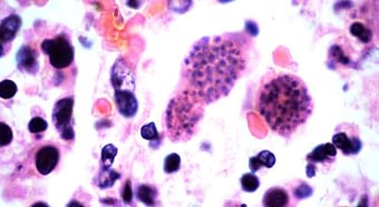 ¿Qué es la toxoplasmosis? como defenderte