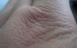 Conoce las imperfecciones de la piel. Consejos prácticos sobre cómo prevenirlos y contrarrestarlos