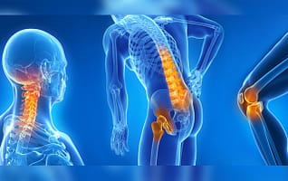 Artrosis: síntomas y tratamientos