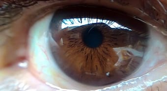 Examen del fondo de ojo: ¿que es y para que sirve?