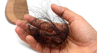 Cómo detener la caída del cabello remedios naturales y lociones